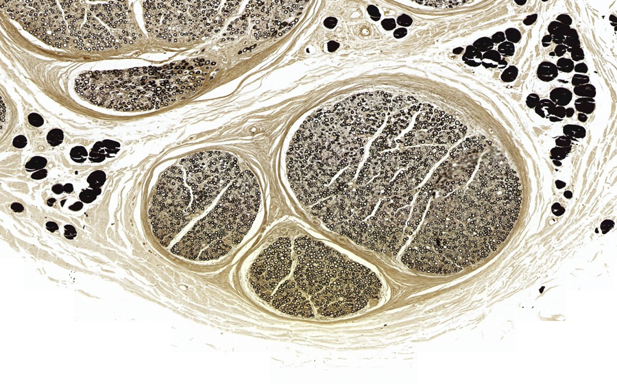Image 2 - Topic 2