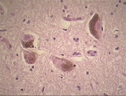 Image 2 - Topic 7