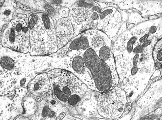 Image 3 - Topic 8-EM, axon-spinous synapse
