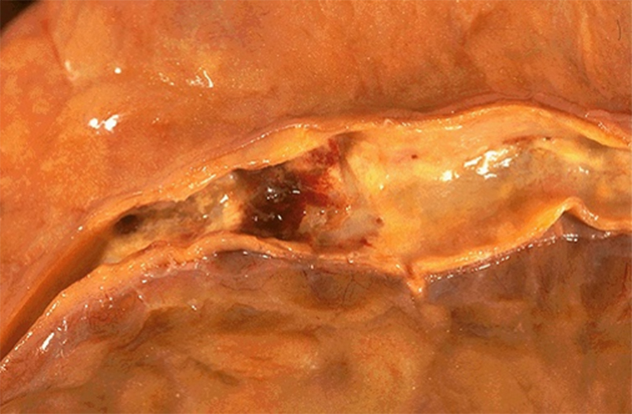 Autopsy 3 - Image 2
