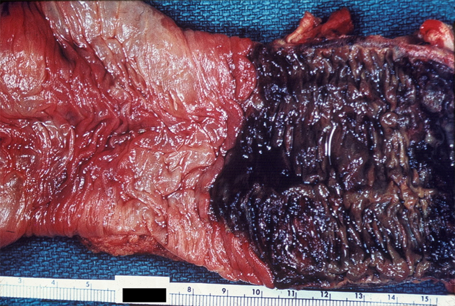 Case 3- Image 2