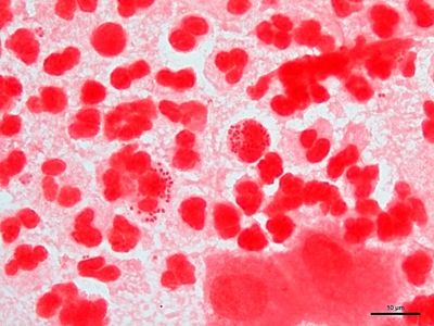 Neisseria gonorrhoeae