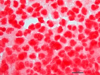 Neisseria gonorrhoeae 02
