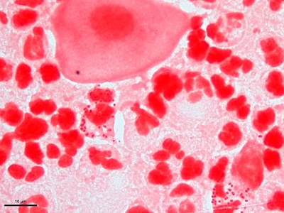 Neisseria gonorrhoeae 03