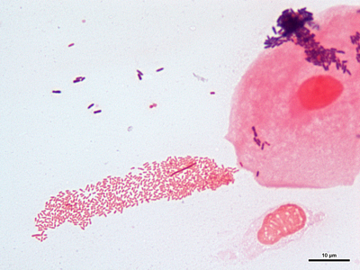 Haemophilus ducreyi 01