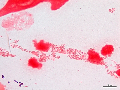 Haemophilus ducreyi 02