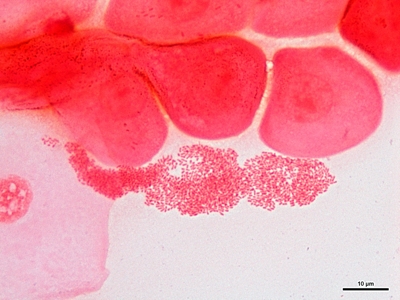 Haemophilus ducreyi 03