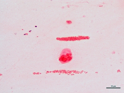 Haemophilus ducreyi 05