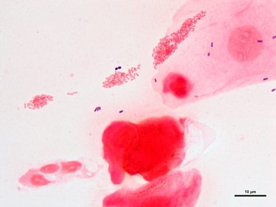 Haemophilus ducreyi 06