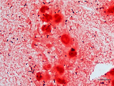 Haemophilus and Beta Streptococcus pneumonia 02