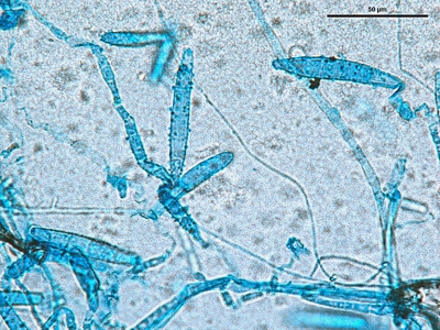 Microsporum canis 01