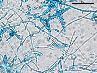 Microsporum canis 02