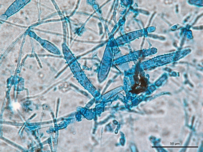 Microsporum canis 04