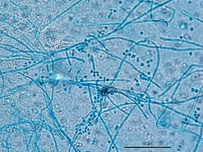 Trichophyton mentagrophytes 01
