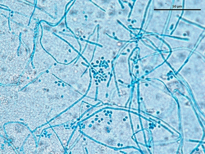 Trichophyton mentagrophytes 02
