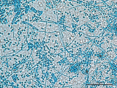 Trichophyton mentagrophytes 03