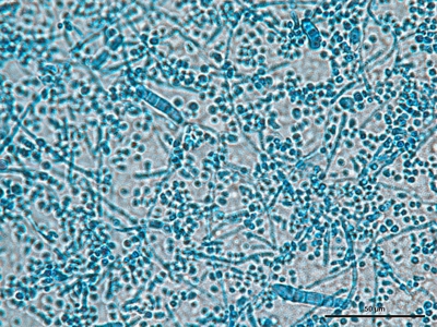 Trichophyton mentagrophytes 04