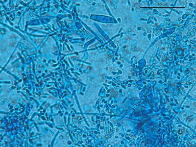 Trichophyton tonsurans 02