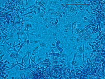 Trichophyton tonsurans 03