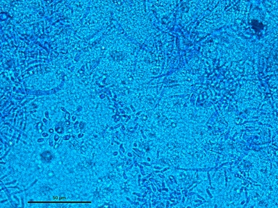 Trichophyton tonsurans 04