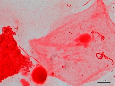 Sputum cultures 03