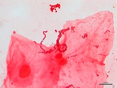 Sputum cultures