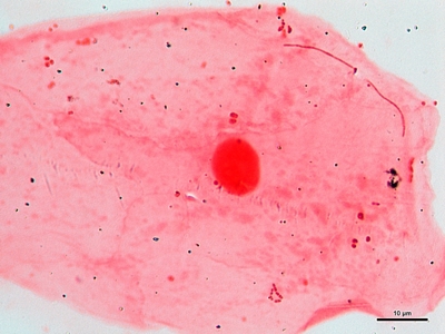 Sputum cultures 05