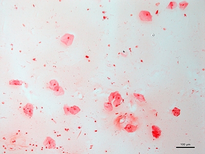 Sputum cultures 01