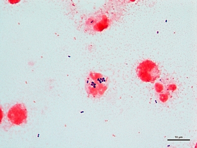 Streptococcus/Staphylococcus/Pseudomonas 02