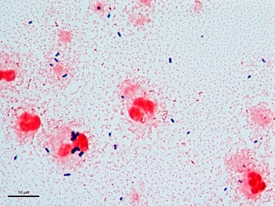 Streptococcus/Staphylococcus/Pseudomonas 04