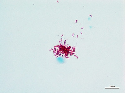Mycobacterium tuberculosis 01