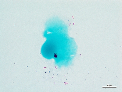 Mycobacterium tuberculosis 02