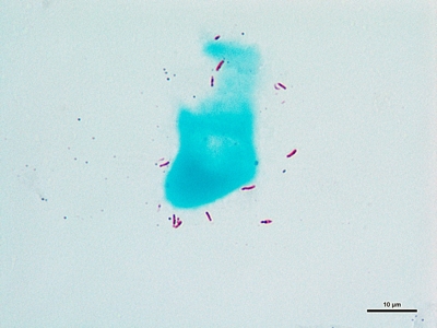 Mycobacterium tuberculosis 03