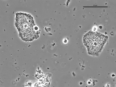 Gardnerella 01