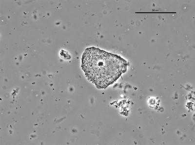 Gardnerella 03