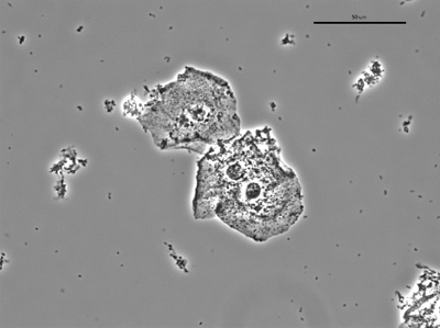 Gardnerella 05