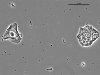 Gardnerella 06