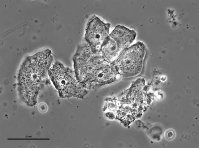 Gardnerella 08