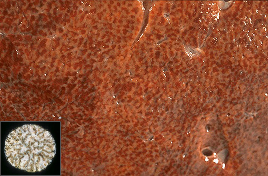 Liver - Chronic passive congestion