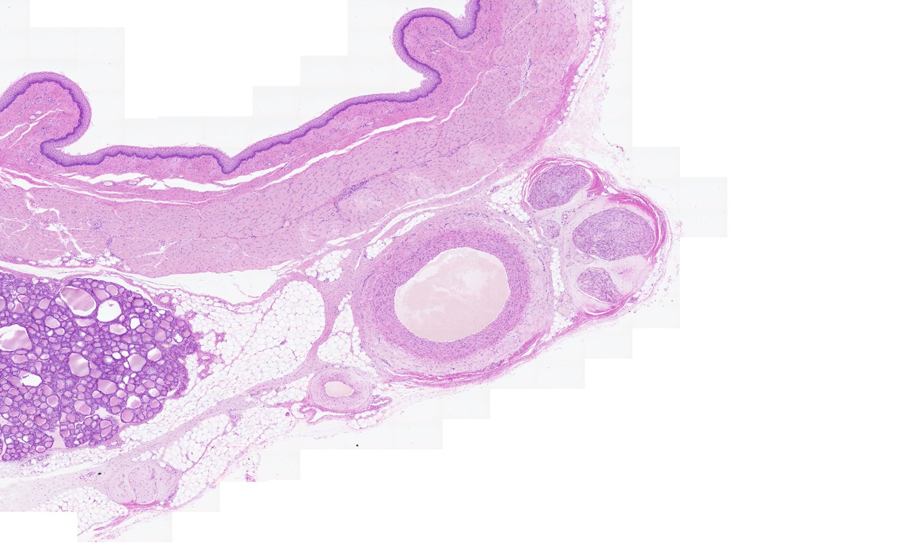 Normal Image 1