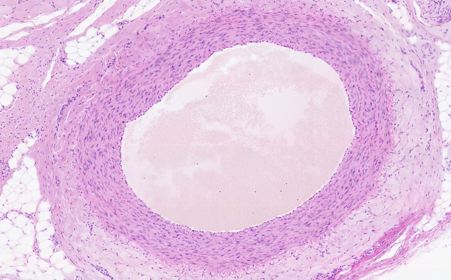 Normal Image 2