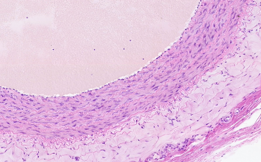 Normal Image 3