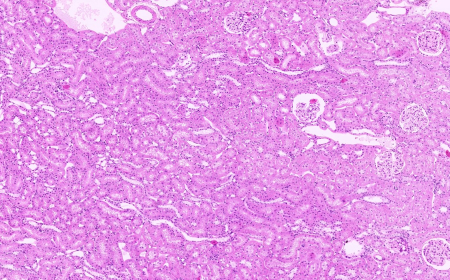 Normal Image 1
