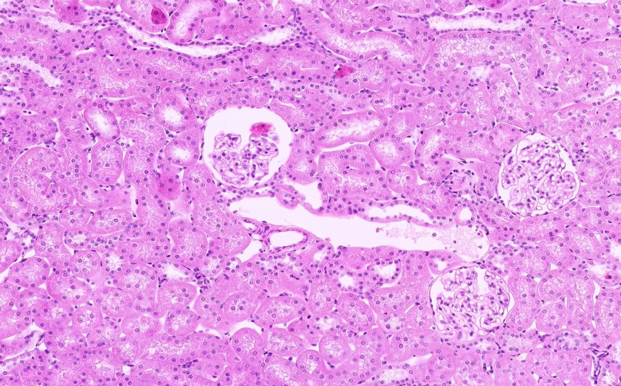 Normal Image 2