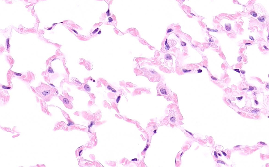 Normal Image 1
