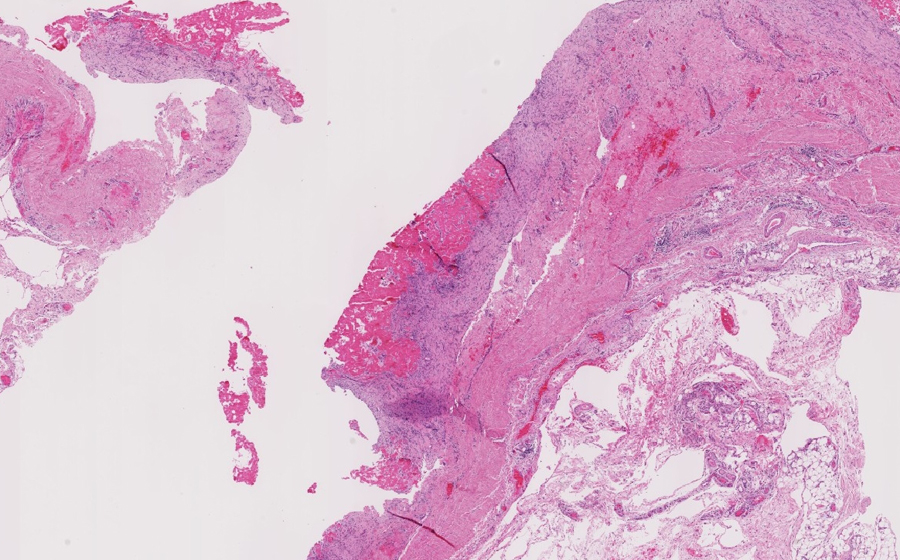 Slide 1 - Image 2