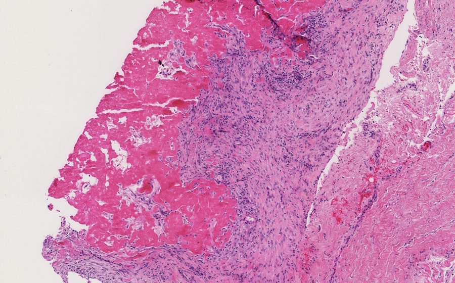 Slide 1 - Image 3