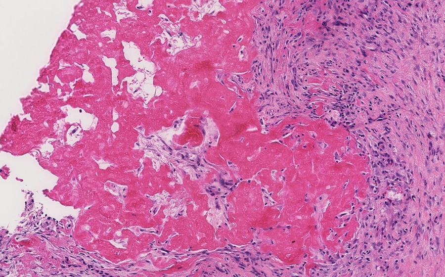 Slide 1 - Image 4