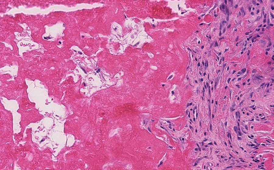 Slide 1 - Image 5