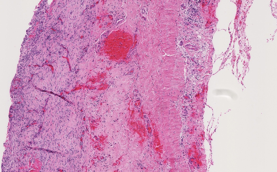 Slide 1 - Image 11